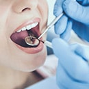 Zahnzusatzversicherung vergleichen